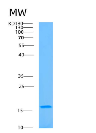 Recombinant Human BATF Protein,Recombinant Human BATF Protein