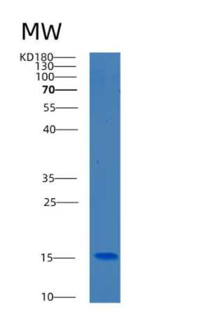 Recombinant Human BDNF Protein,Recombinant Human BDNF Protein