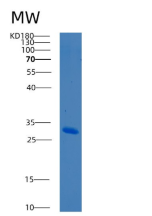 Recombinant Human BCL10 Protein,Recombinant Human BCL10 Protein