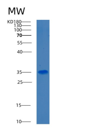 Recombinant Human BDH1 Protein,Recombinant Human BDH1 Protein