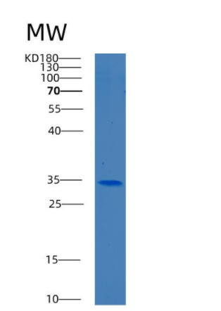 Recombinant Human BEND6 Protein,Recombinant Human BEND6 Protein