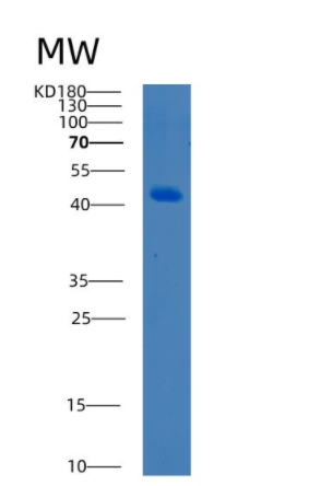 Recombinant Human BCAT2 Protein,Recombinant Human BCAT2 Protein