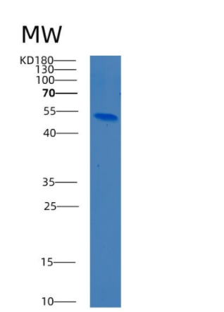 Recombinant Human Beta-Ala-His dipeptidase Protein,Recombinant Human Beta-Ala-His dipeptidase Protein