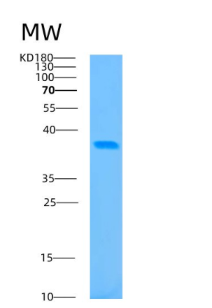 Recombinant Human BABAM1 Protein,Recombinant Human BABAM1 Protein