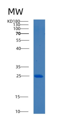 Recombinant Human BCL7A Protein,Recombinant Human BCL7A Protein