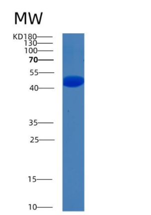 Recombinant Human BHMT2 Protein,Recombinant Human BHMT2 Protein