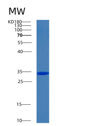 Recombinant Human Biliverdin reductase A Protein,Recombinant Human Biliverdin reductase A Protein