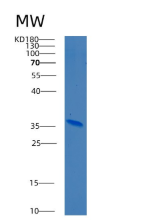 Recombinant Human BEST1 Protein,Recombinant Human BEST1 Protein