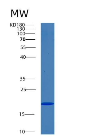 Recombinant Human BIGH3 Protein,Recombinant Human BIGH3 Protein