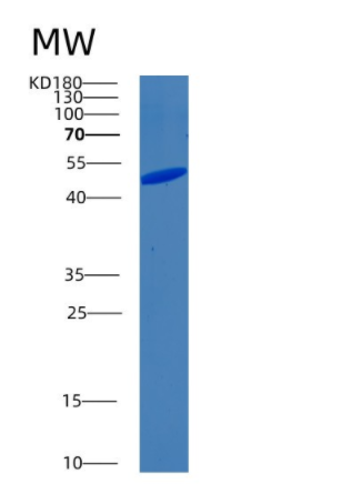 Recombinant Human BIN1 Protein,Recombinant Human BIN1 Protein