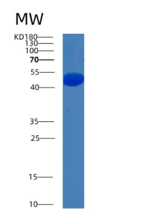 Recombinant Human BHMT (βine-homocysteine methyltransferase) Human Protein,Recombinant Human BHMT (βine-homocysteine methyltransferase) Human Protein