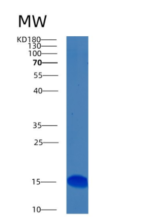 RecombinantHumanBMP5 Protein,RecombinantHumanBMP5 Protein