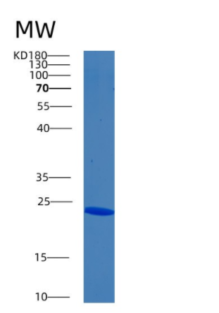 Recombinant Human Biliverdin reductase B Protein,Recombinant Human Biliverdin reductase B Protein