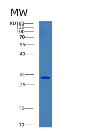 Recombinant Human BPGM Protein,Recombinant Human BPGM Protein