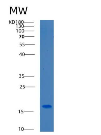 Recombinant Human BEX1 Protein,Recombinant Human BEX1 Protein