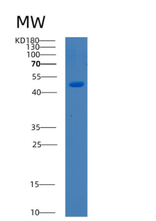 Recombinant BRD2 Protein,Recombinant BRD2 Protein