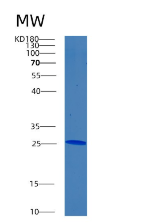 Recombinant Human BNIP1 Protein,Recombinant Human BNIP1 Protein