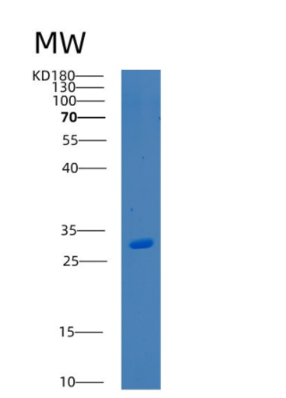 Recombinant Human BSND Protein,Recombinant Human BSND Protein