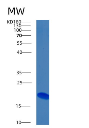 Recombinant Human BMP6 Protein,Recombinant Human BMP6 Protein