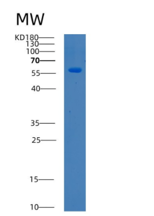 Recombinant Human BTD Protein,Recombinant Human BTD Protein