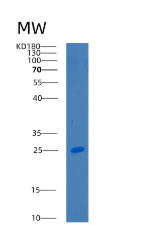 Recombinant Mouse C-reactive protein Protein,Recombinant Mouse C-reactive protein Protein