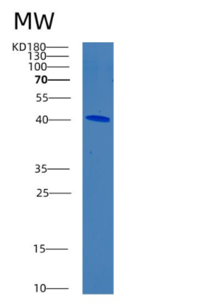 Recombinant Human BRAF Protein,Recombinant Human BRAF Protein