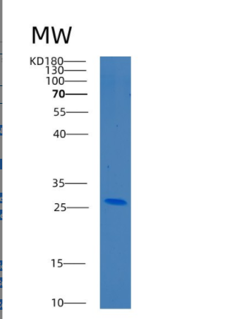 Recombinant Human C8G Protein,Recombinant Human C8G Protein
