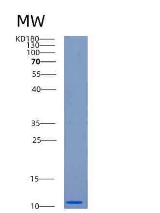 Recombinant Human CAMK2N2 Protein,Recombinant Human CAMK2N2 Protein