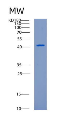 Recombinant Human CANT1 Protein,Recombinant Human CANT1 Protein