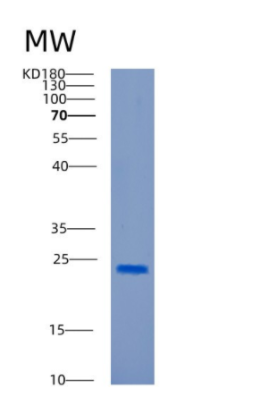 Recombinant Human CAPNS1 Protein,Recombinant Human CAPNS1 Protein