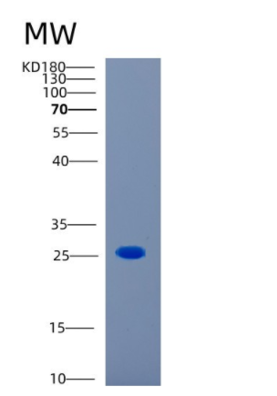 Recombinant Human CAPSL Protein,Recombinant Human CAPSL Protein