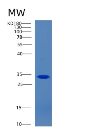 Recombinant Human CAPZA2 Protein,Recombinant Human CAPZA2 Protein