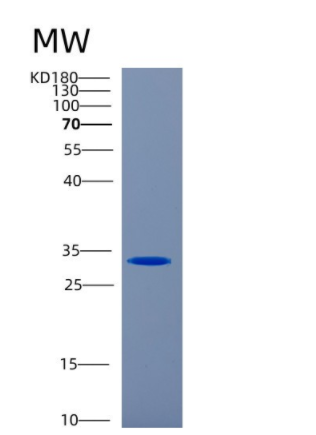 Recombinant Human Carbonic anhydrase 1 Protein,Recombinant Human Carbonic anhydrase 1 Protein