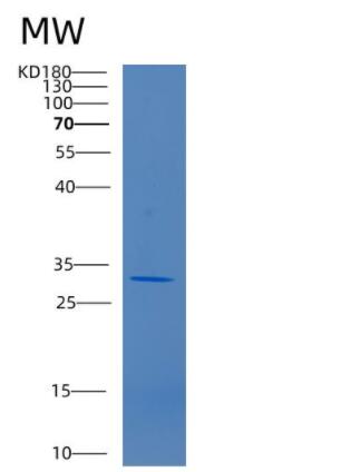 Recombinant Human CD34 Protein,Recombinant Human CD34 Protein