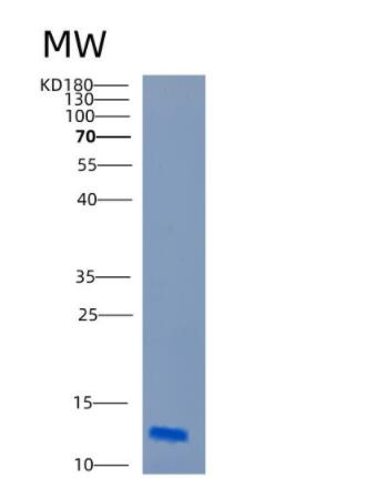 Recombinant Human CARD18 Protein,Recombinant Human CARD18 Protein