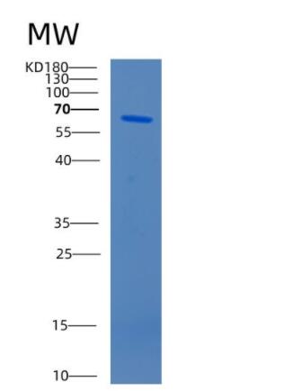 Recombinant Human CAT Protein,Recombinant Human CAT Protein