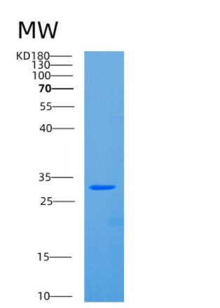 Recombinant Human CBR1 Protein,Recombinant Human CBR1 Protein