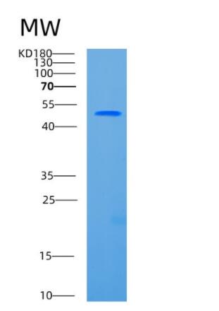 Recombinant Human CCBL1 Protein,Recombinant Human CCBL1 Protein