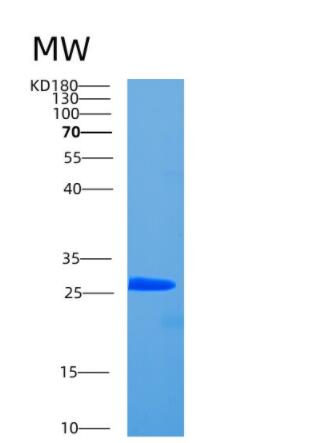 Recombinant Human CCDC25 Protein,Recombinant Human CCDC25 Protein