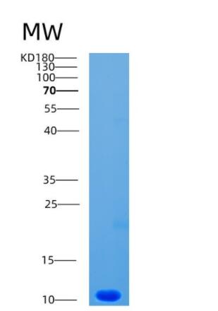 Recombinant Human CCL1 Protein,Recombinant Human CCL1 Protein