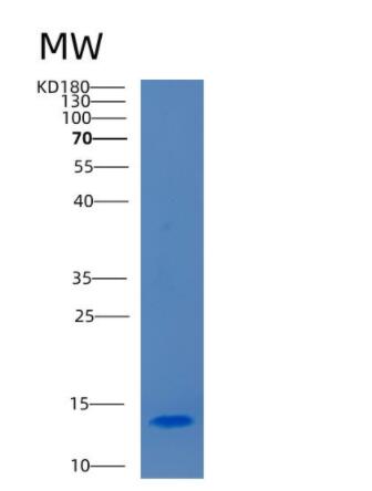 Recombinant Human CCL28 Protein,Recombinant Human CCL28 Protein
