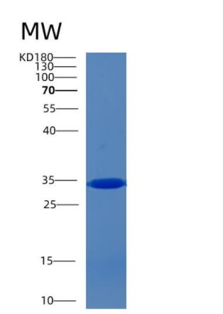 Recombinant Human CCM2 Protein,Recombinant Human CCM2 Protein