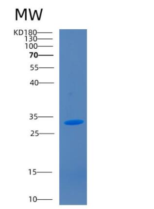 Recombinant Human CD1A Protein,Recombinant Human CD1A Protein