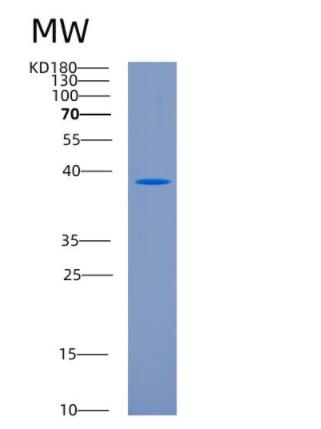 Recombinant Human CD207 Protein,Recombinant Human CD207 Protein