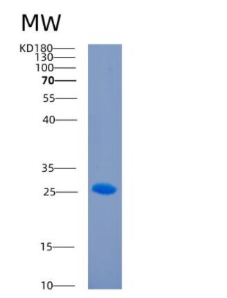 Recombinant Human CD244 Protein,Recombinant Human CD244 Protein