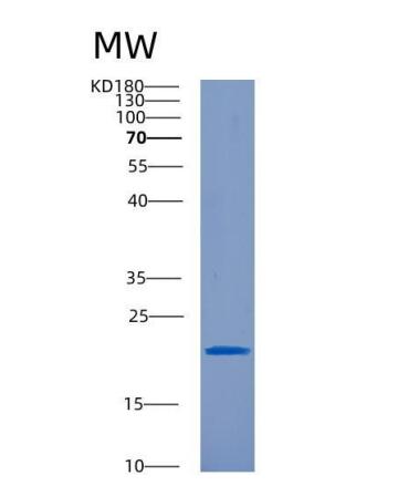 Recombinant Tumor Necrosis Factor Receptor Superfamily, Member 7 (TNFRSF7),Recombinant Tumor Necrosis Factor Receptor Superfamily, Member 7 (TNFRSF7)