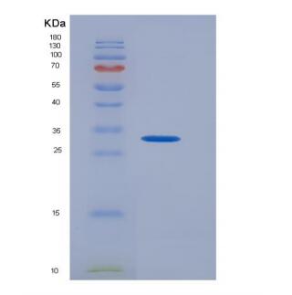 Recombinant Human CD274 Protein,Recombinant Human CD274 Protein