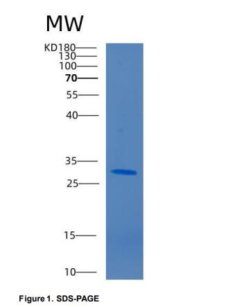 Recombinant Human CD33 Protein,Recombinant Human CD33 Protein