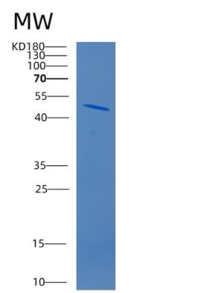 Recombinant Human CD320 Protein,Recombinant Human CD320 Protein