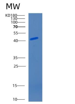 Recombinant Mouse Cathepsin E Protein,Recombinant Mouse Cathepsin E Protein